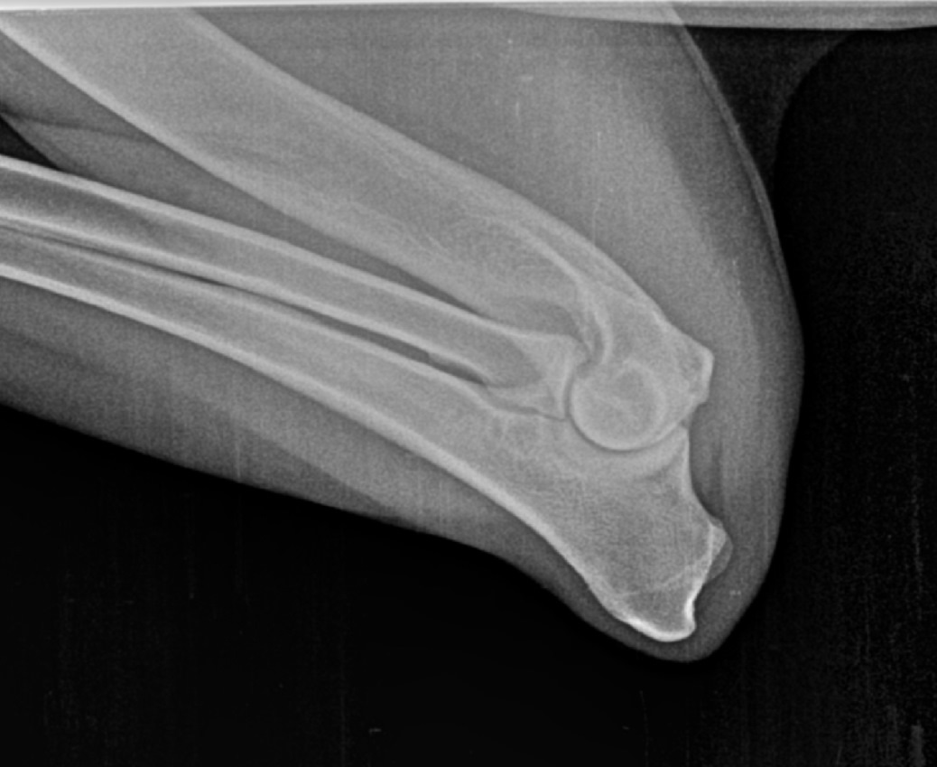 elbow #1